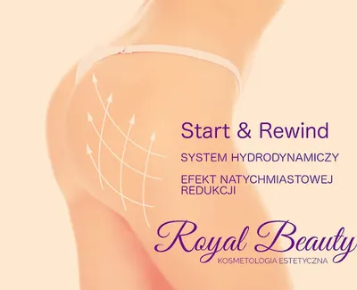 Royal Beauty - Kosmetologia Estetyczna, Depilacja Laserowa